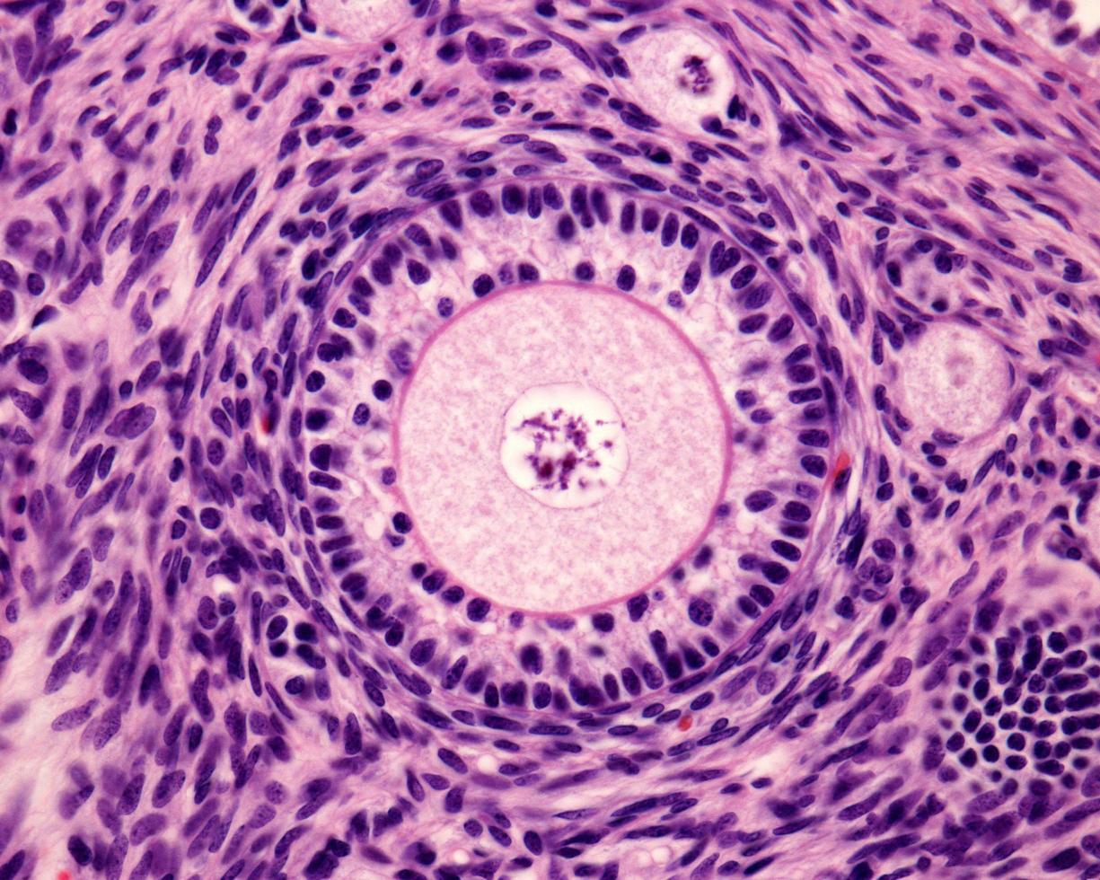 Primary ovary follicle photo