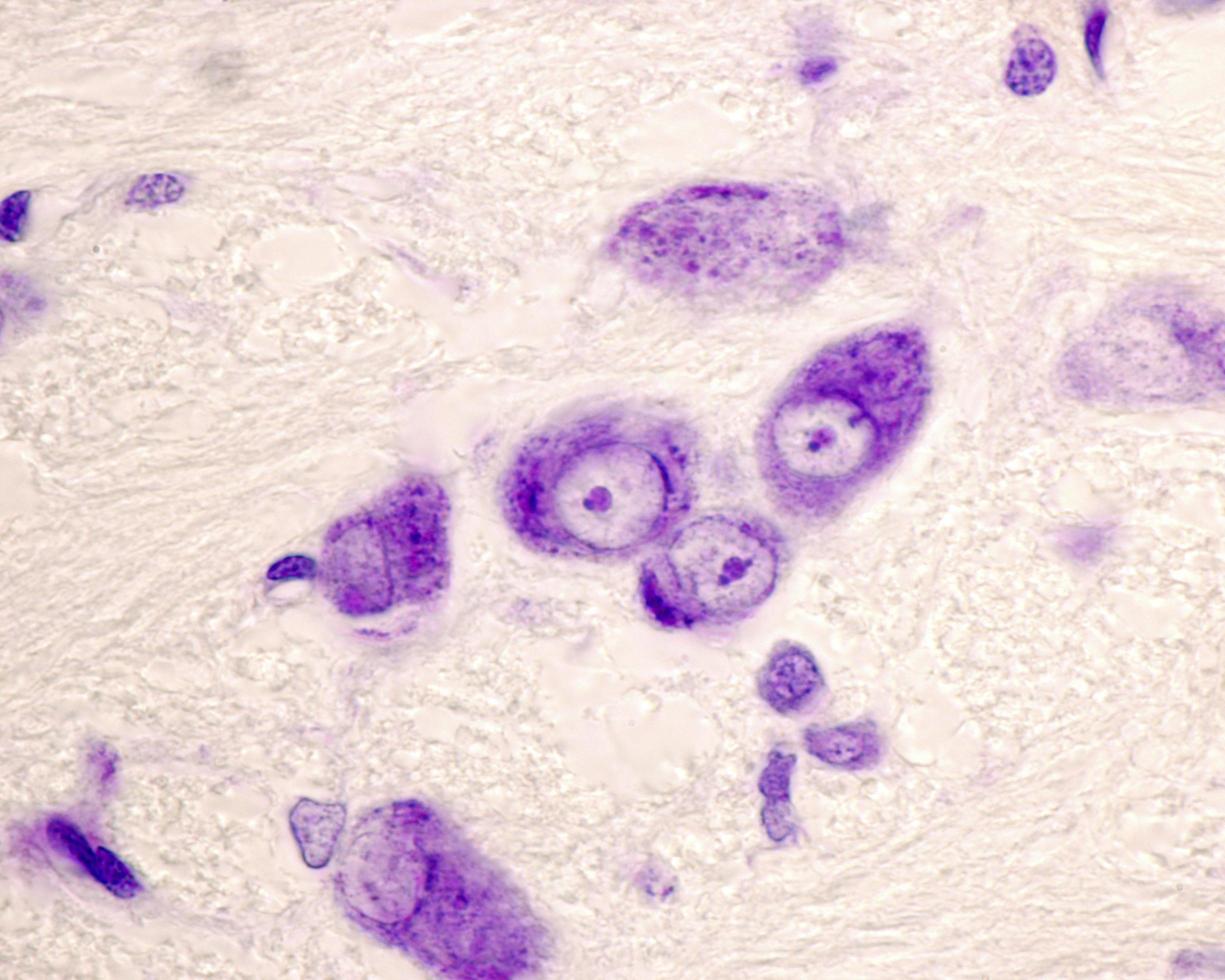 Barr body Neuron photo
