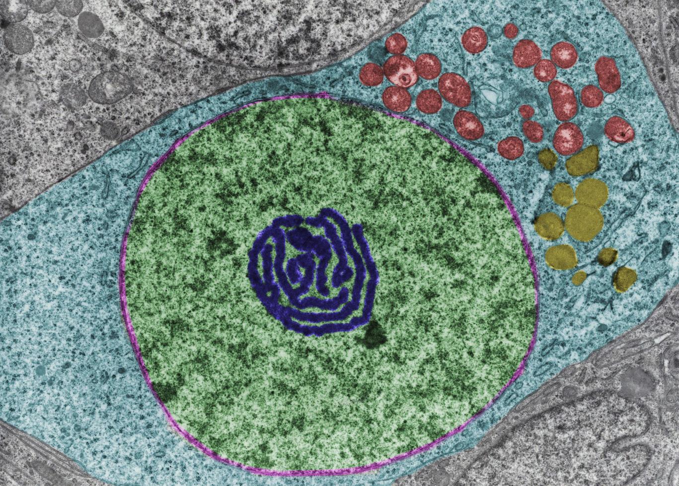 Nucleolus FaLse colour TEM photo