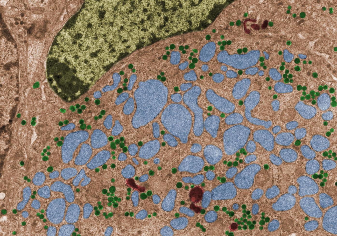 Gonadotropic cell False colour TEM photo