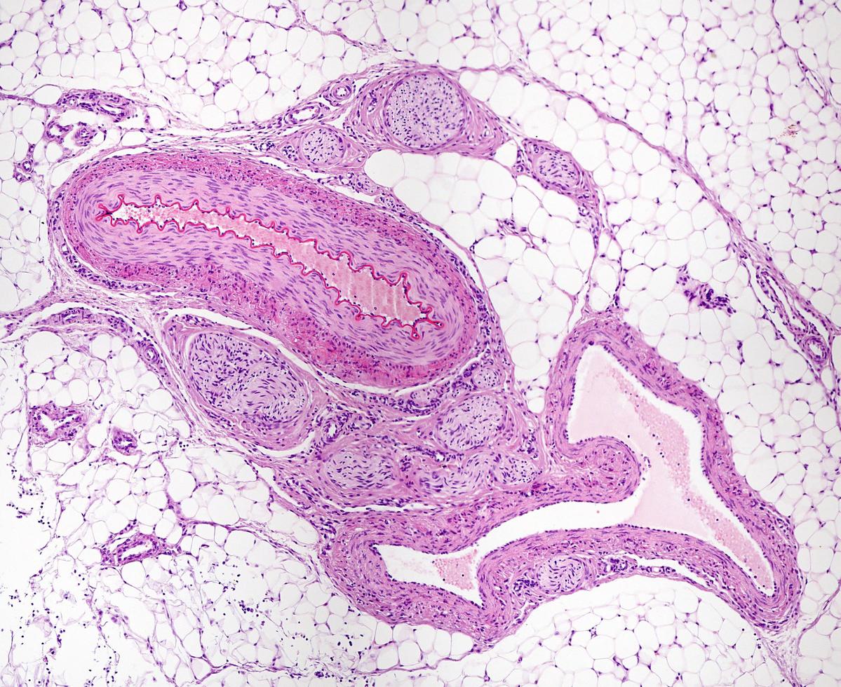 Blood vessels and nerves photo