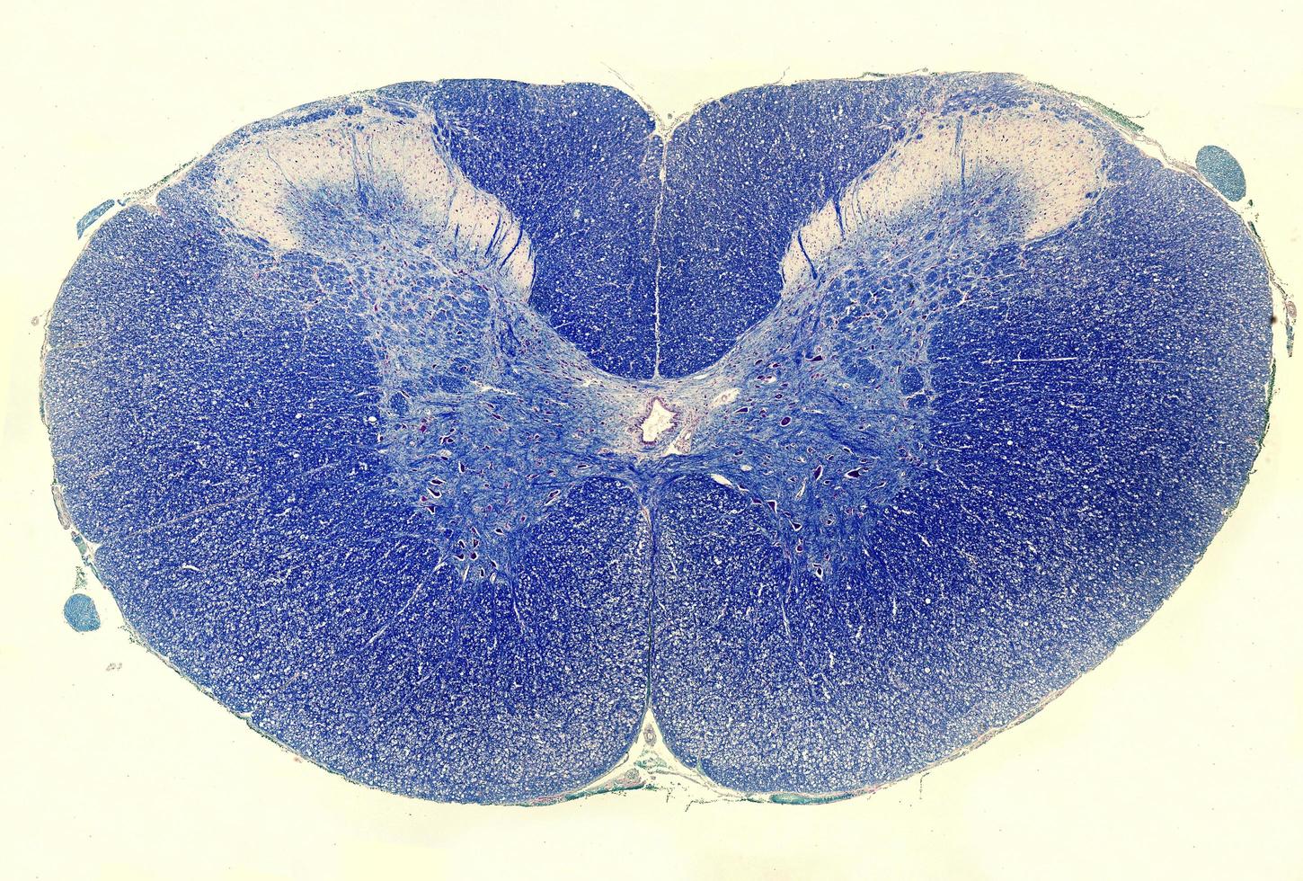 Spinal cord Luxol Fast Blue stain photo