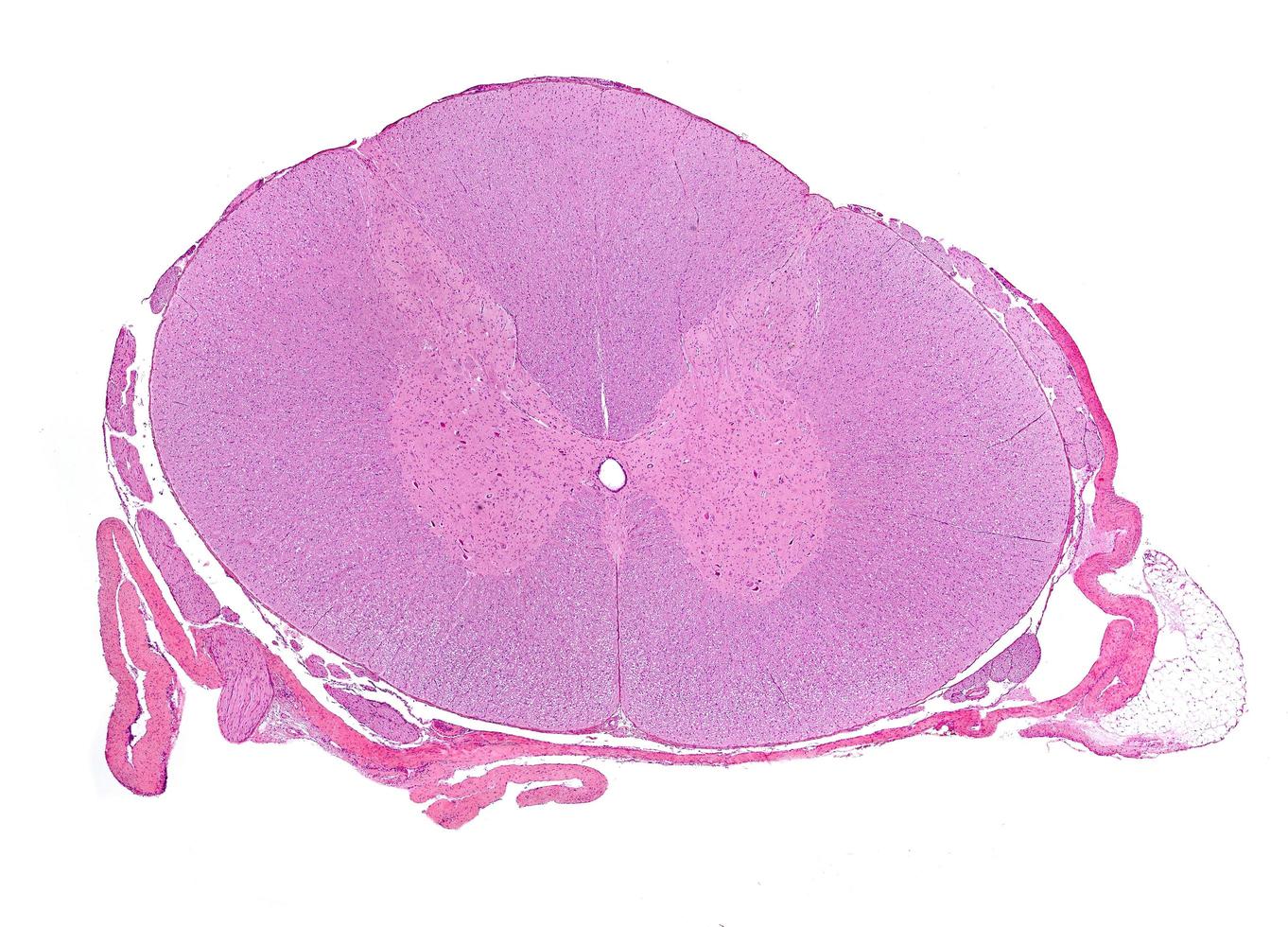 sección transversal de la médula espinal foto