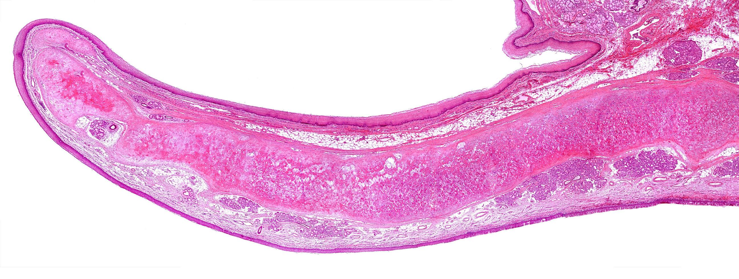 Human epiglottis sagittal section photo