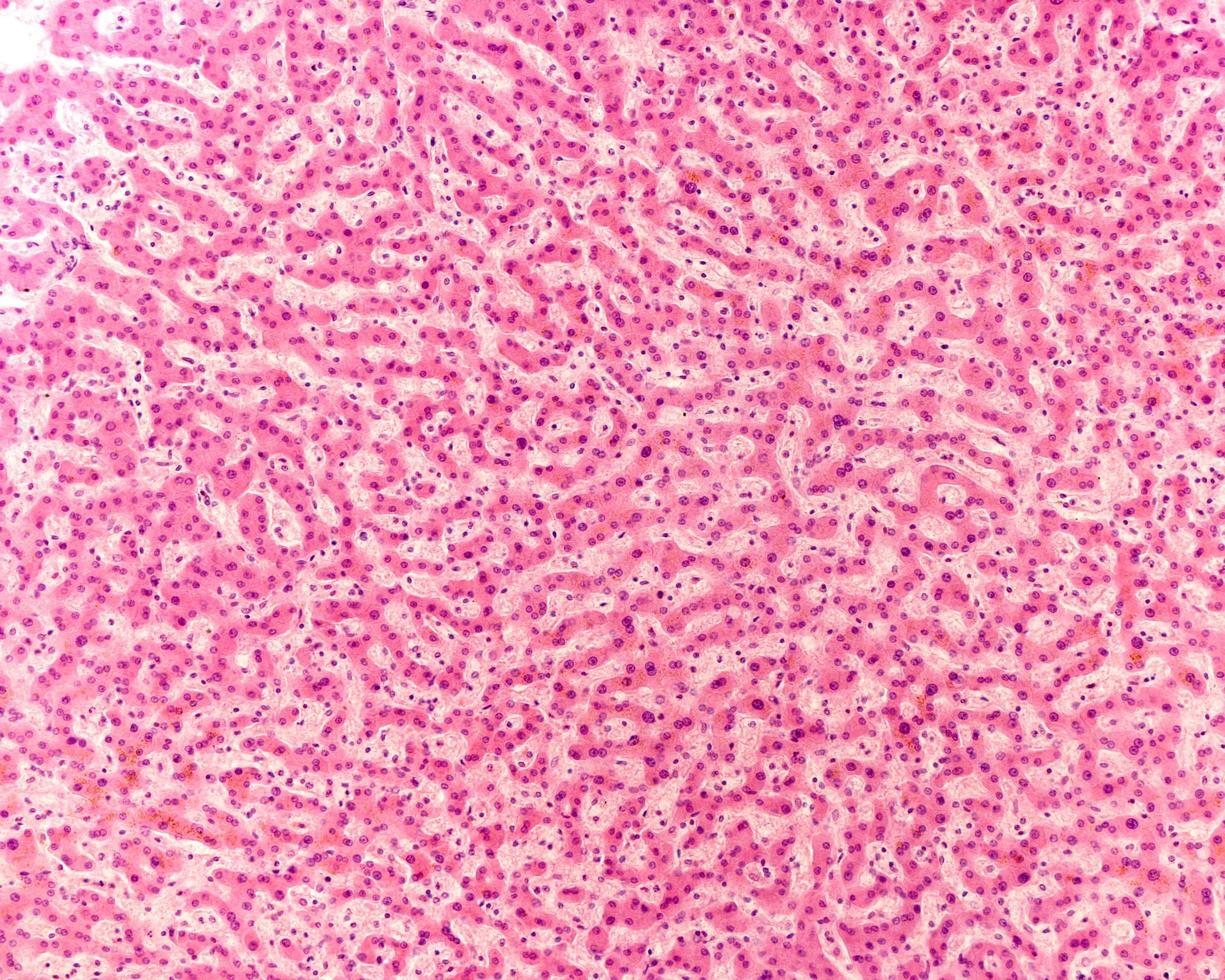 Human liver micrograph photo