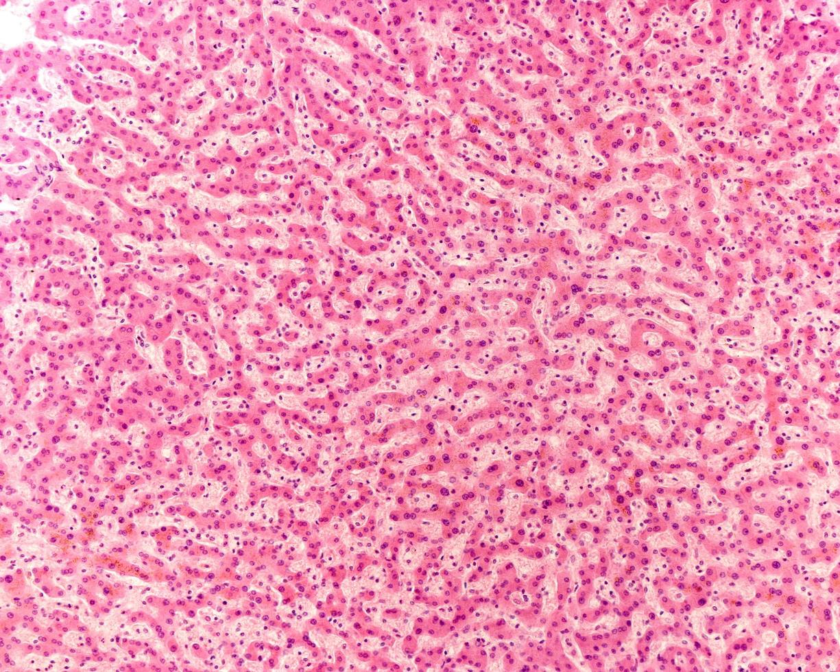 Human liver micrograph photo