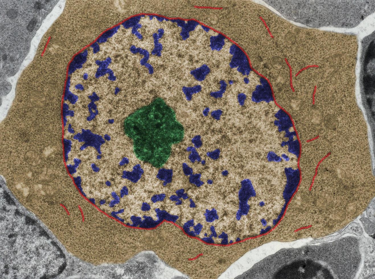 Activated B lymphocyte False colour TEM photo