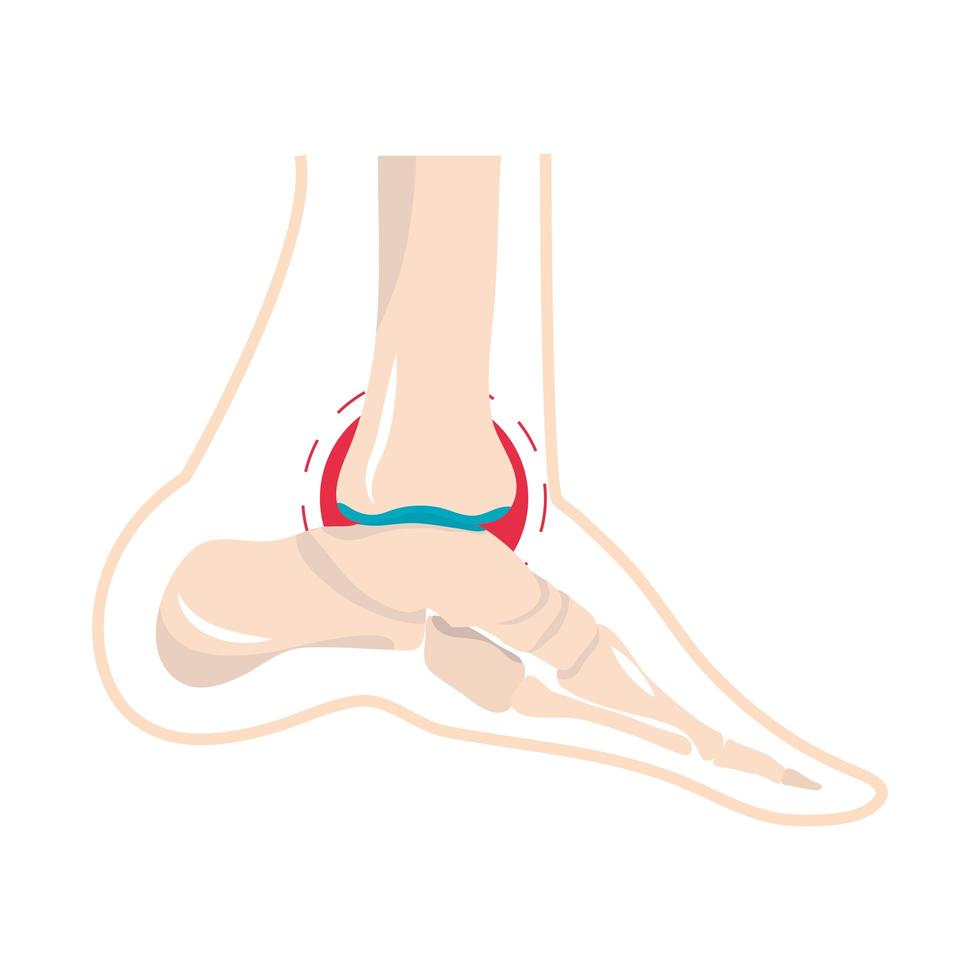 dolor artritis reumatología vector