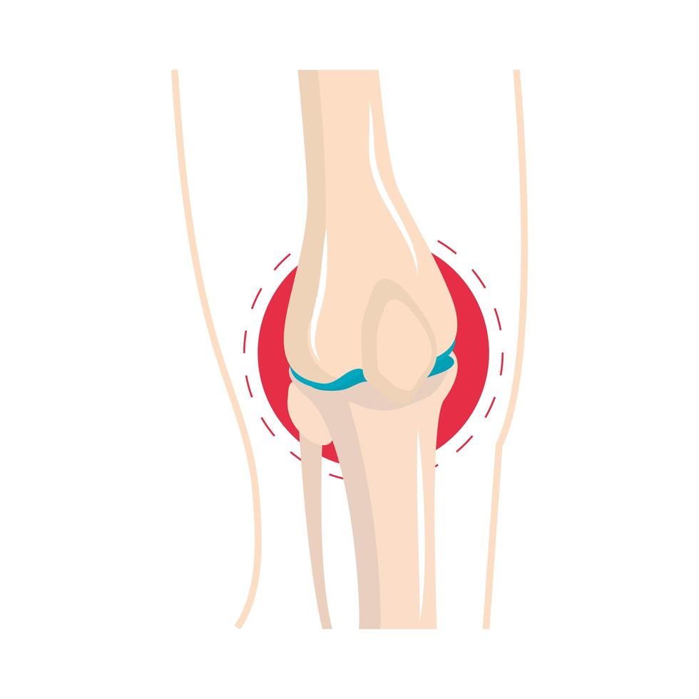 rheumatism knee swelling vector