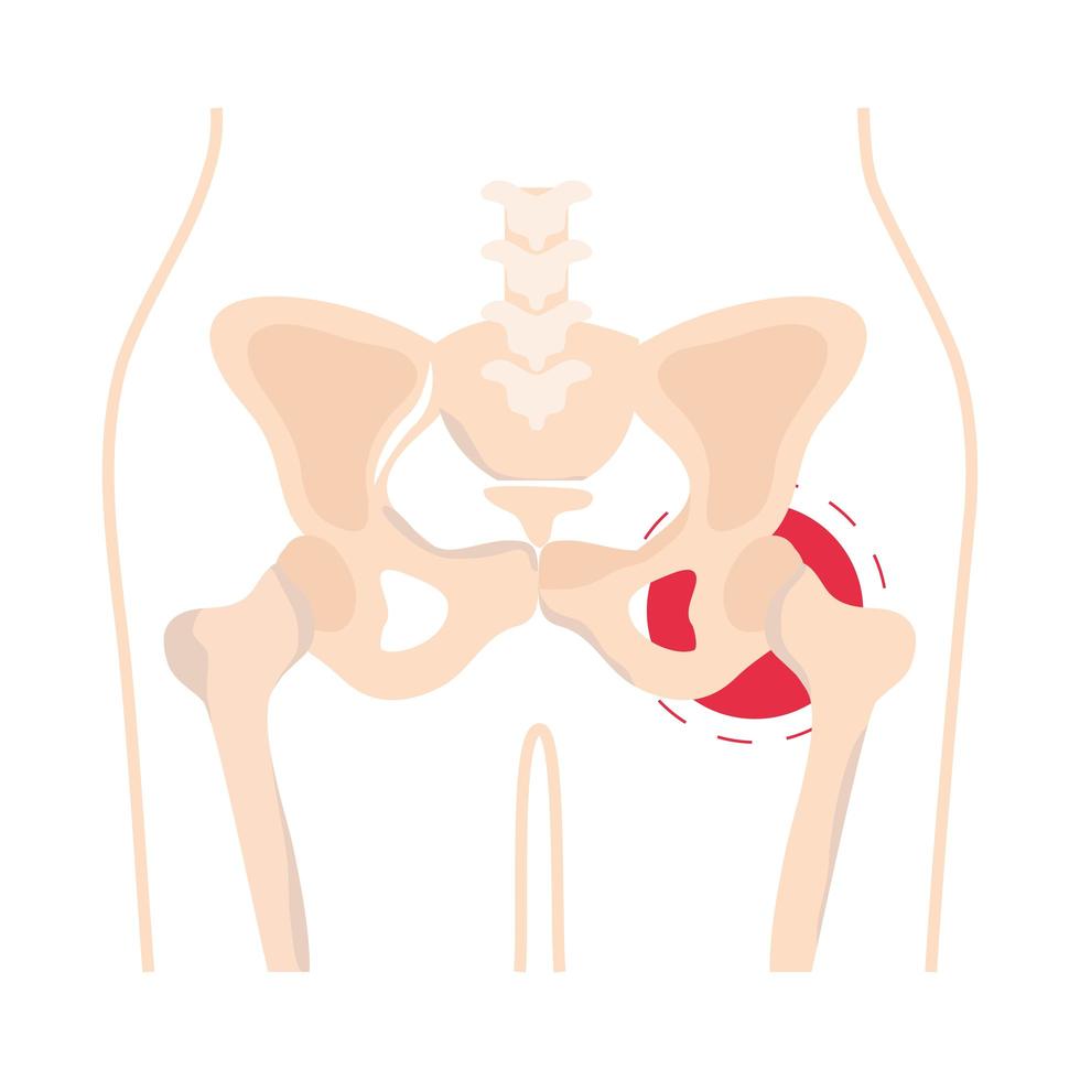 reumatología pelvis huesos vector