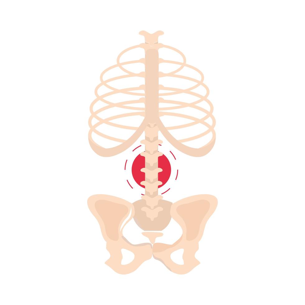 articulación de la columna de reumatismo vector