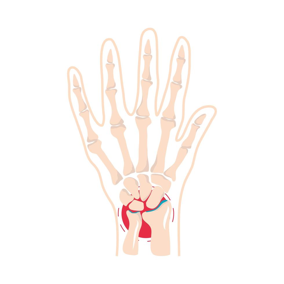 rheumatism bones pain vector