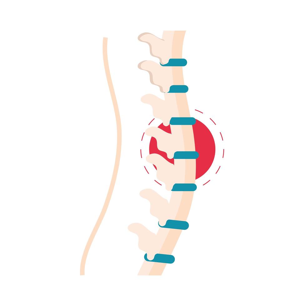 rheumatism vertebral column vector