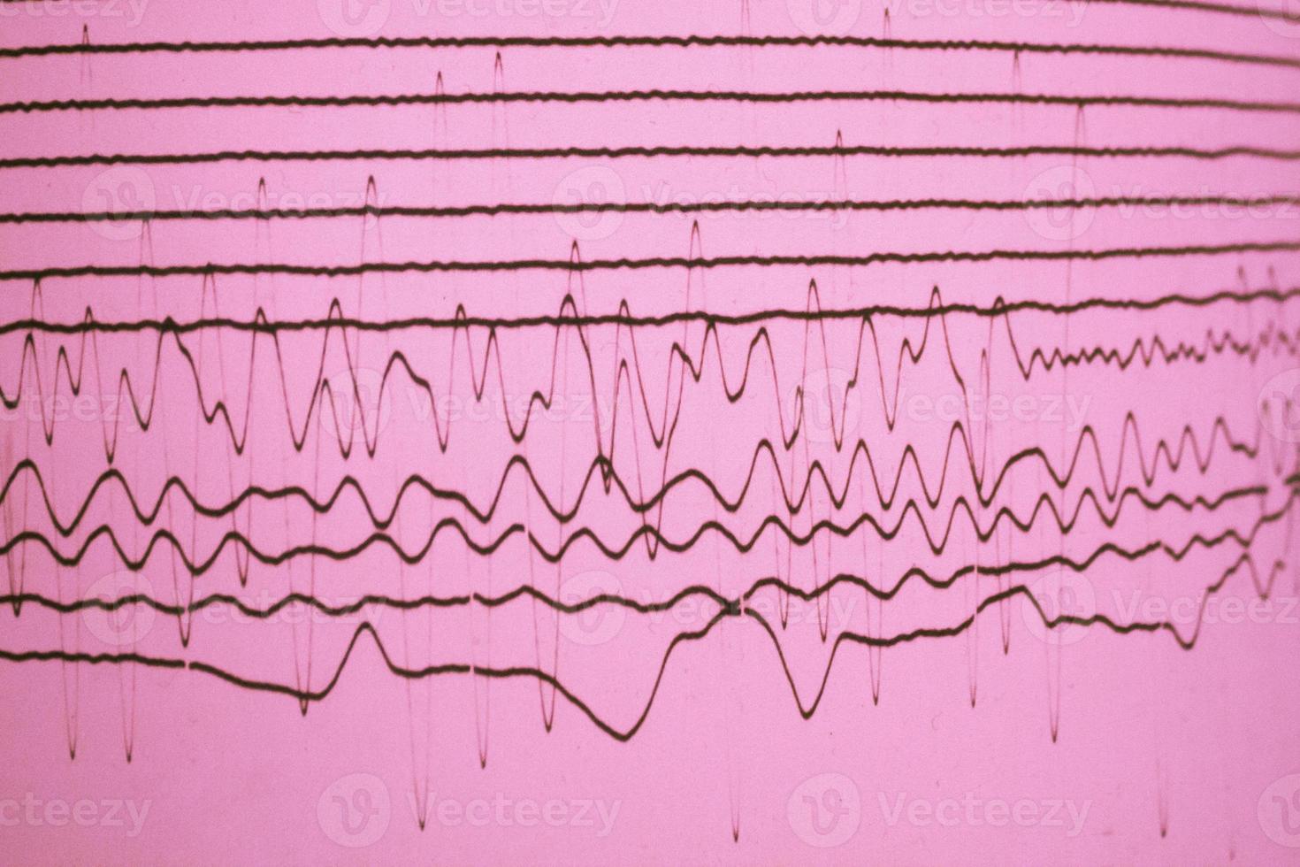 Magnitudo lines on purple paper photo
