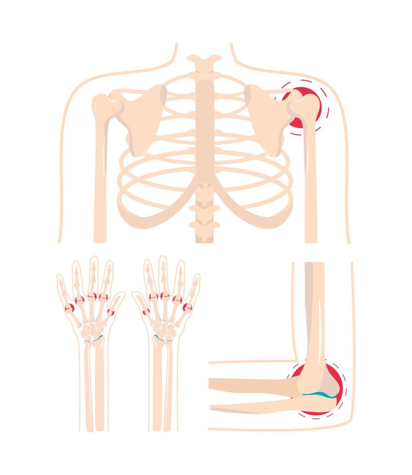 artritis lesión dolorosa vector