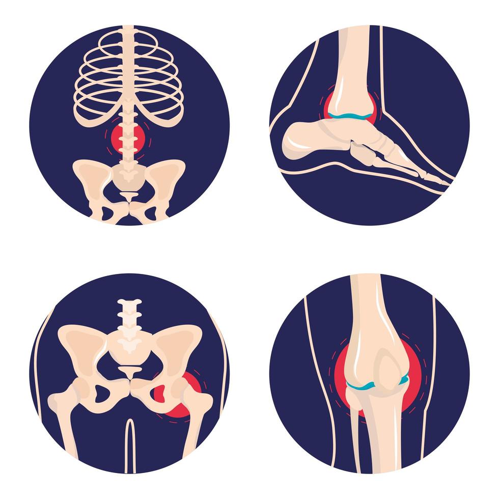 set arthritis rheumatology vector