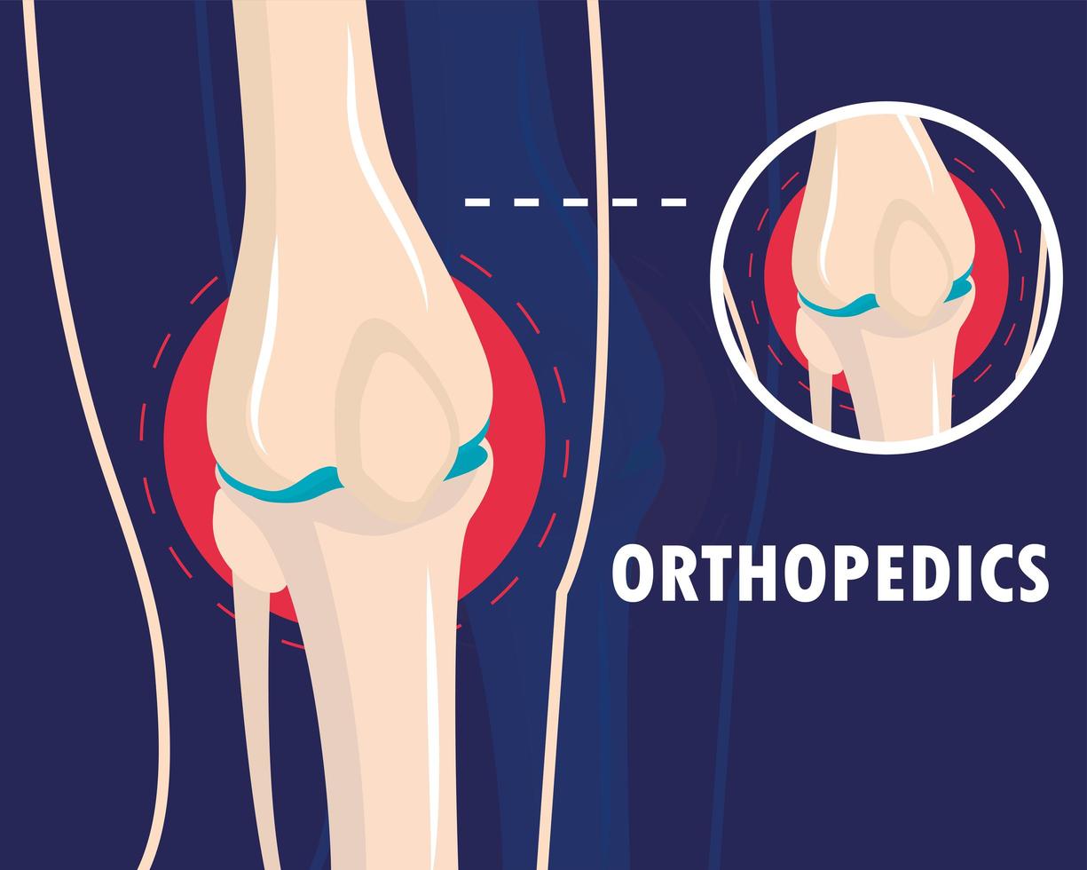 orthopedics rheumatism arthritis vector