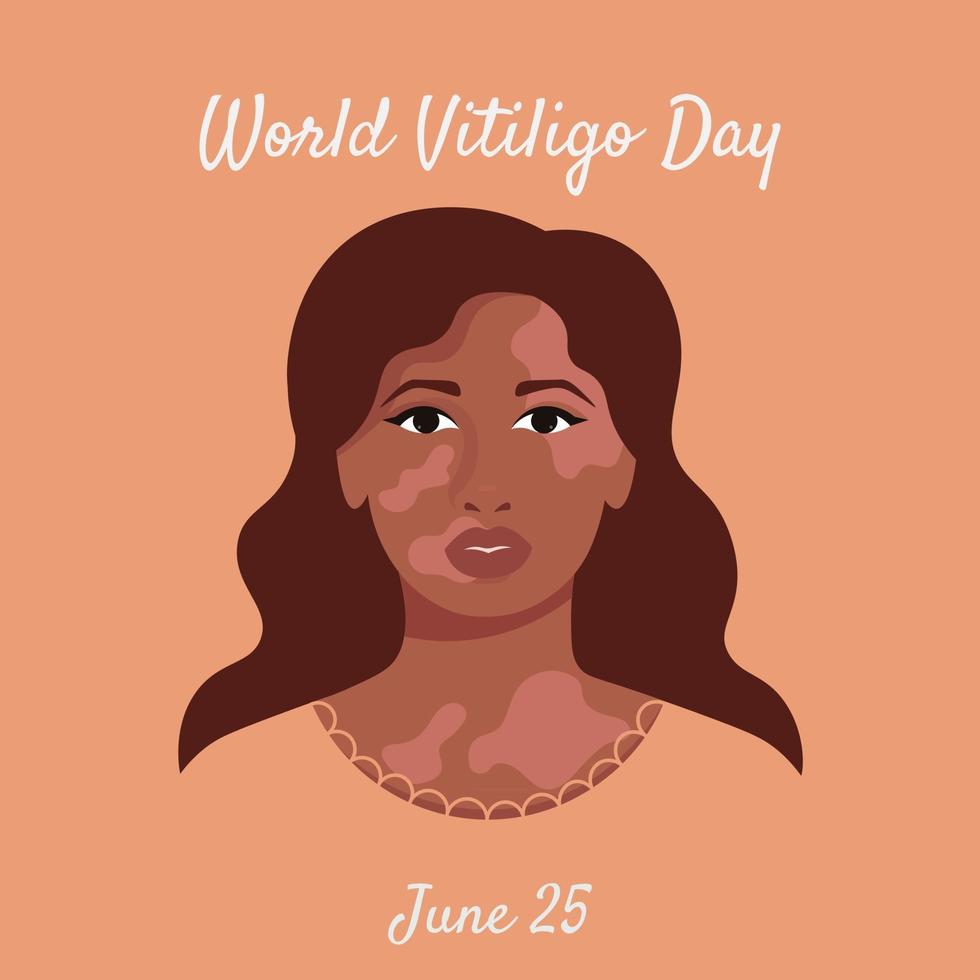 Woman portrait with vitiligo vector