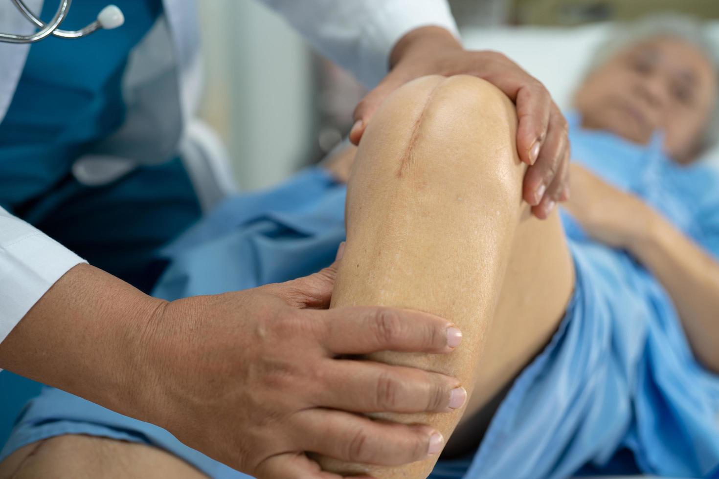 anciana asiática mayor o anciana mujer paciente mostrar sus cicatrices quirúrgico reemplazo total de la articulación de la rodilla sutura herida cirugía artroplastia en la cama en la sala del hospital de enfermería foto