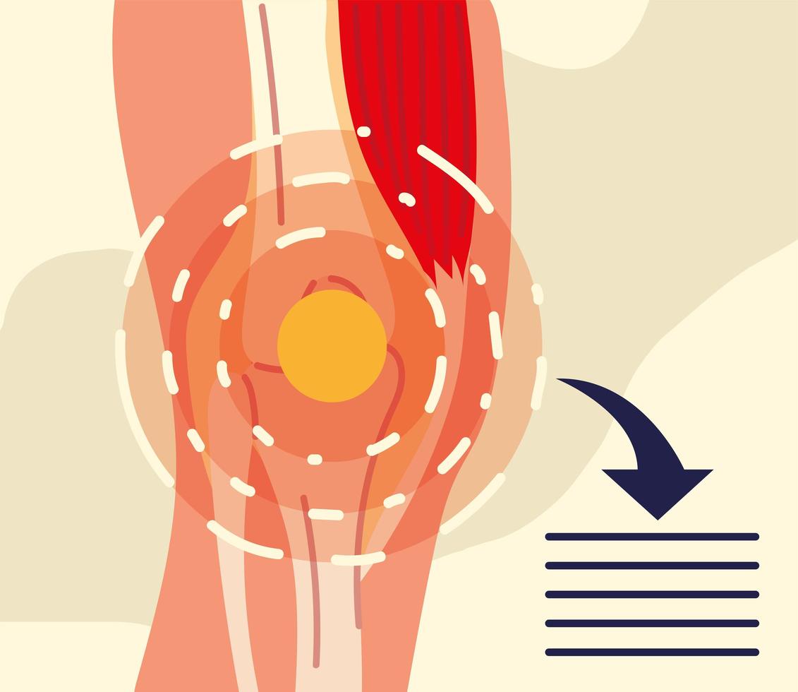 rheumatology knee banner vector