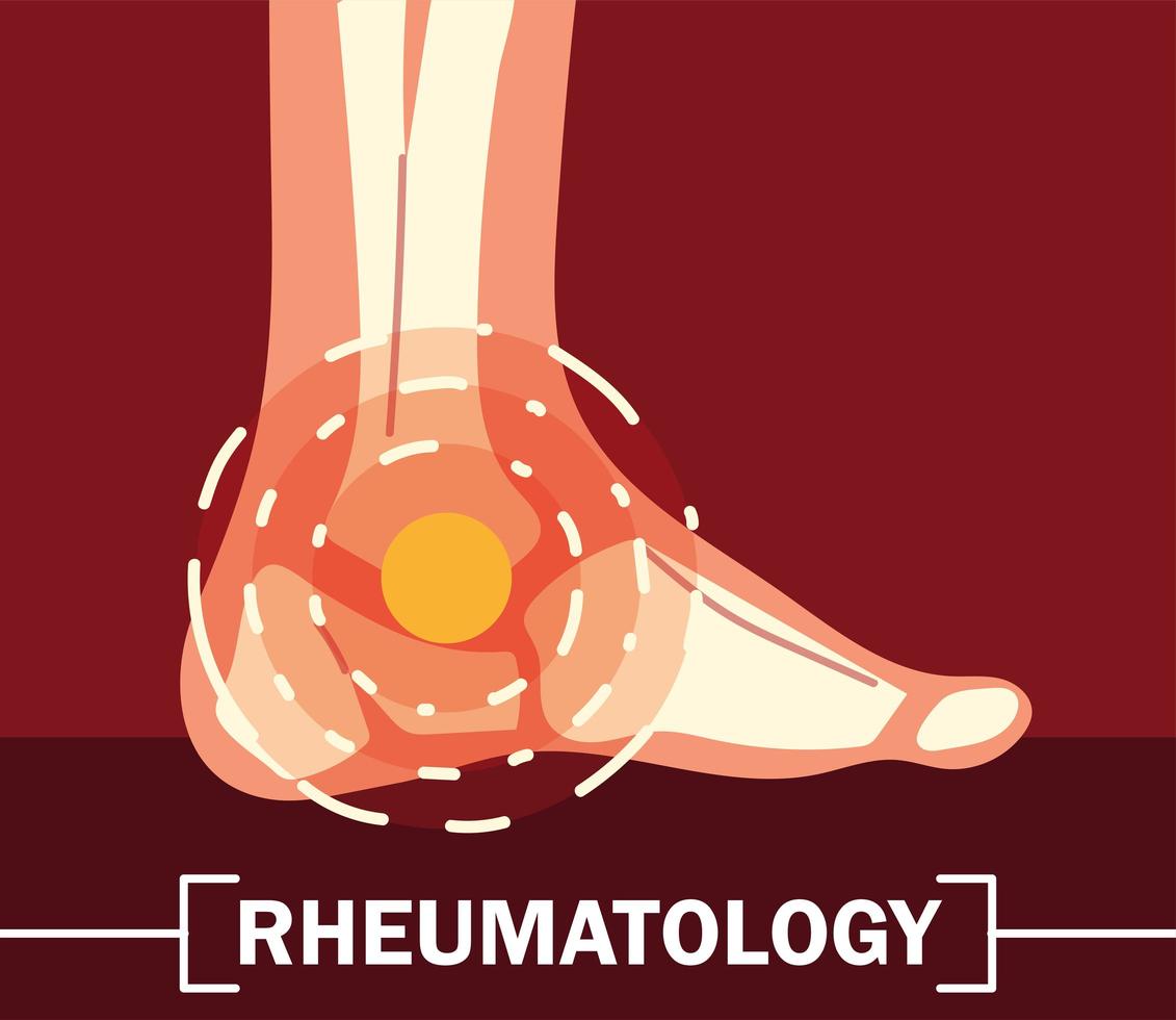 rheumatology ankle bones vector