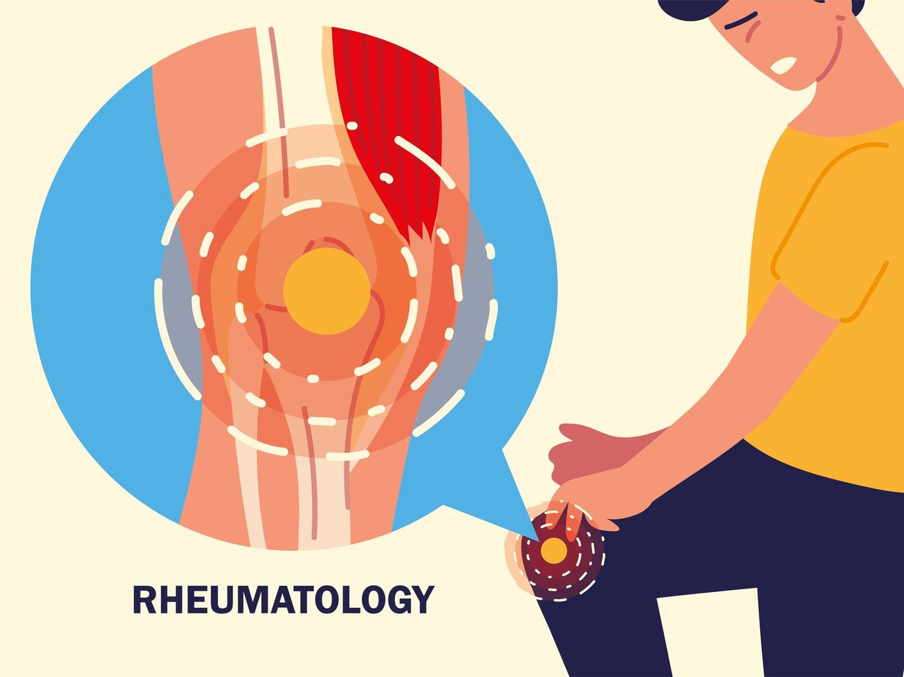 rodilla reumática humana vector