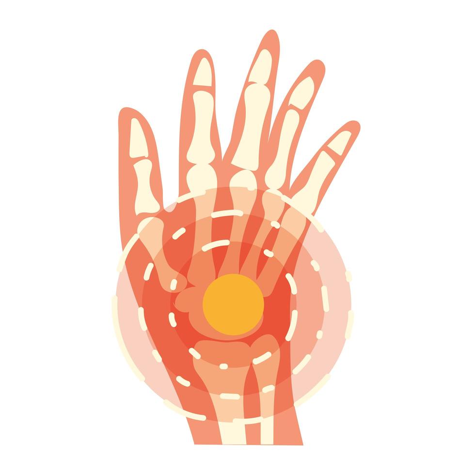 arthritis wrist pain vector