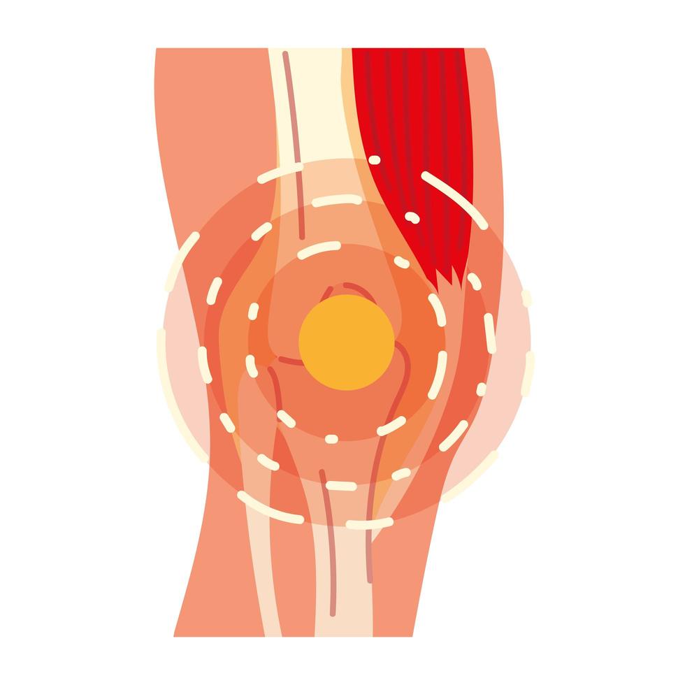 arthritis leg pain vector