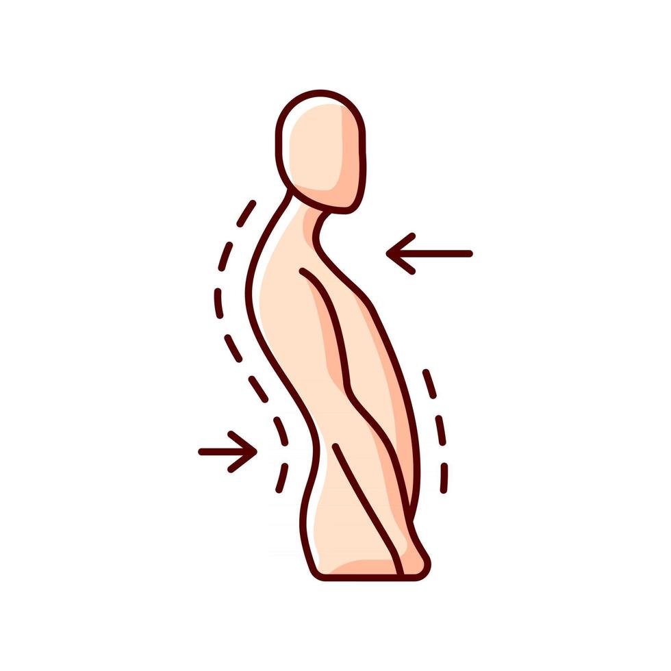 Swayback posture RGB color icon. Spine curvature disorder. Poor posture. Postural deformity. Backward thoracic spine movement. Ligament sprain. Muscle imbalances. Isolated vector illustration