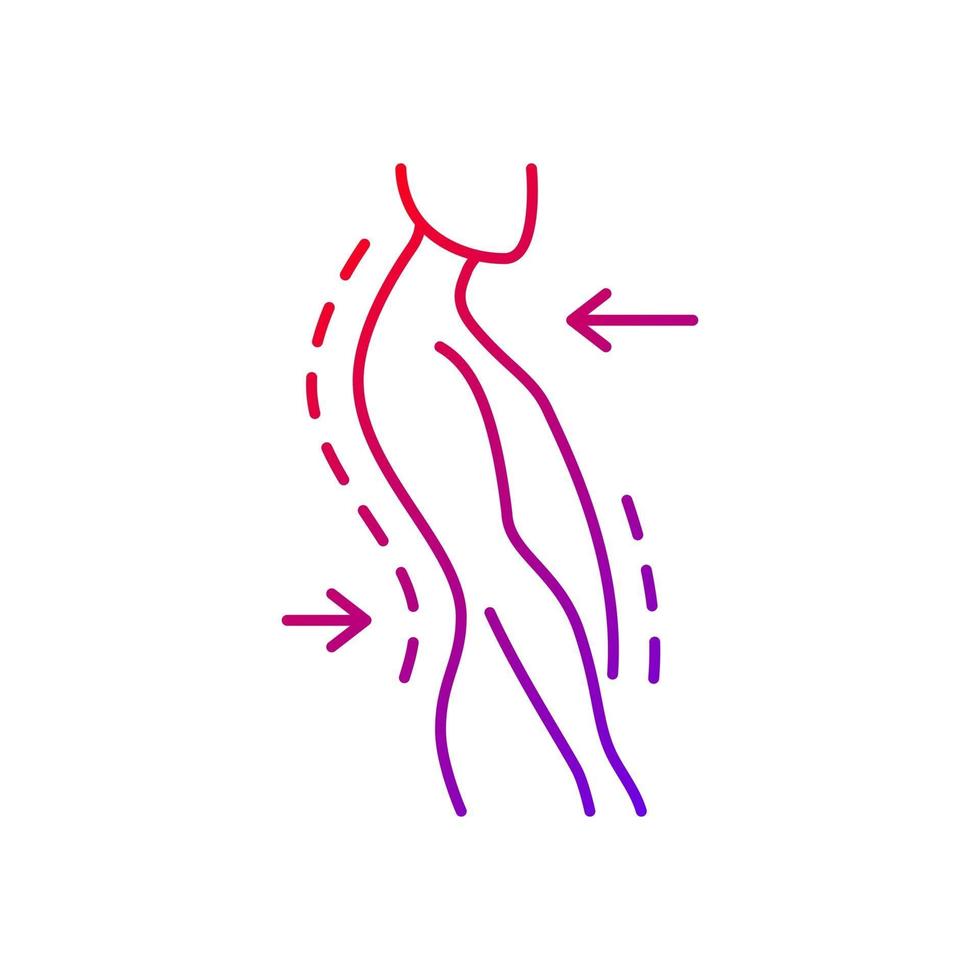 icono de vector lineal de gradiente de postura de swayback. trastorno de la curvatura de la columna vertebral. postura pobre. deformidad postural. símbolos de color de línea fina. pictograma de estilo moderno. dibujo de contorno aislado vectorial