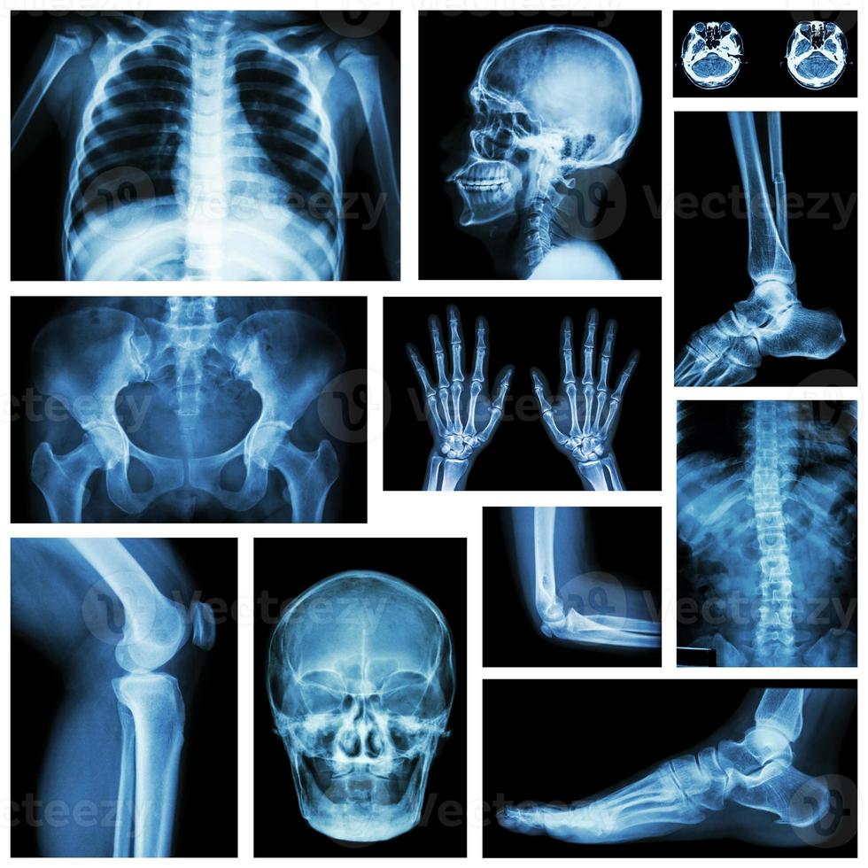 Conjunto de rayos X de múltiples partes del ser humano. sistema esquelético . foto