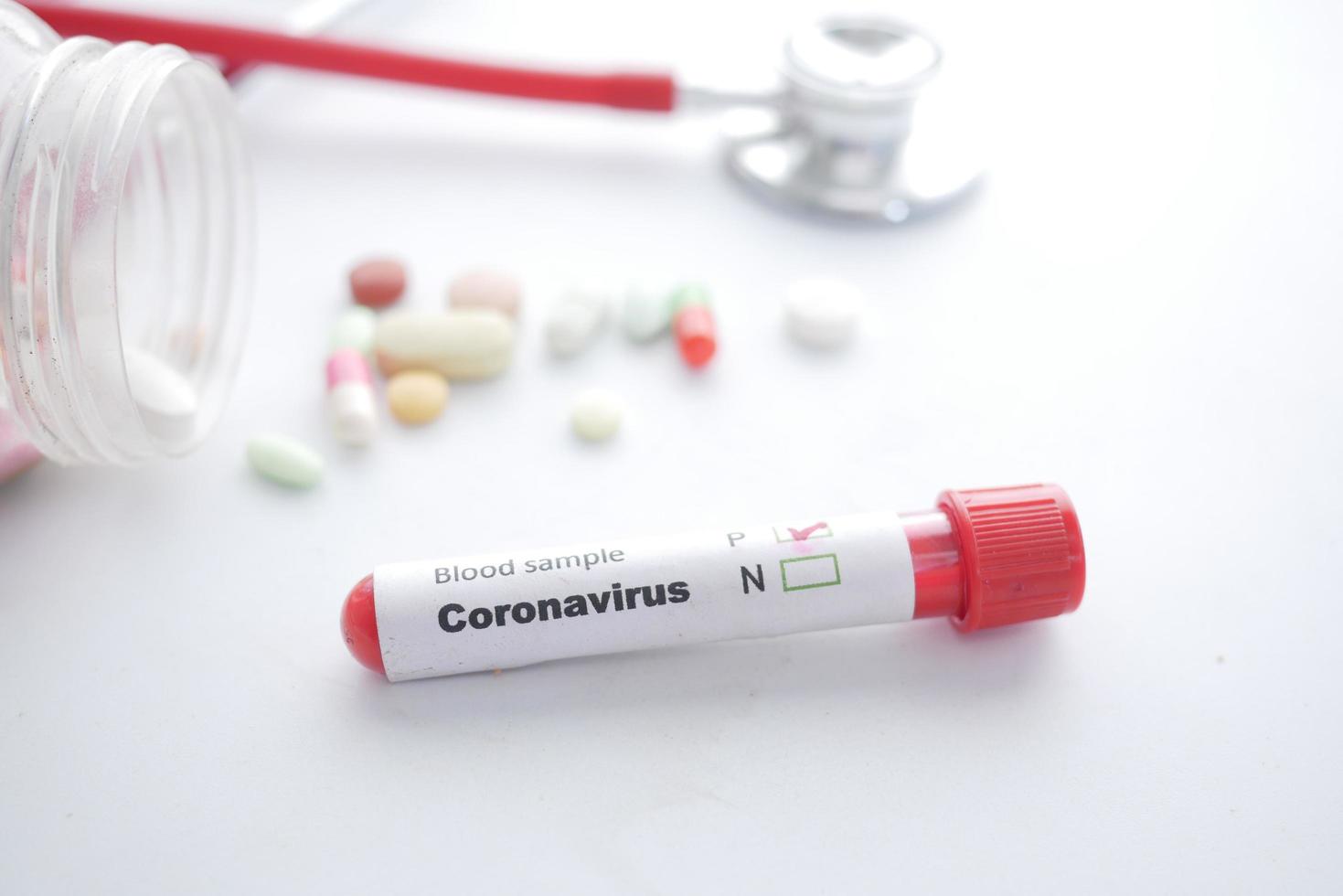 Close up of corona virus blood test tube on white background photo