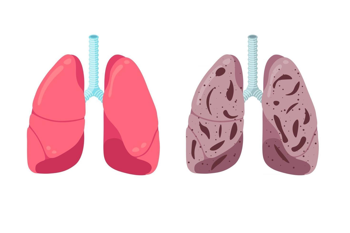 pulmones sanos y no saludables comparan el concepto. Inflamación fuerte del órgano interno del sistema respiratorio humano y de la neumonía. Ilustración de vector de anatomía de condición médica de respiración de atención médica