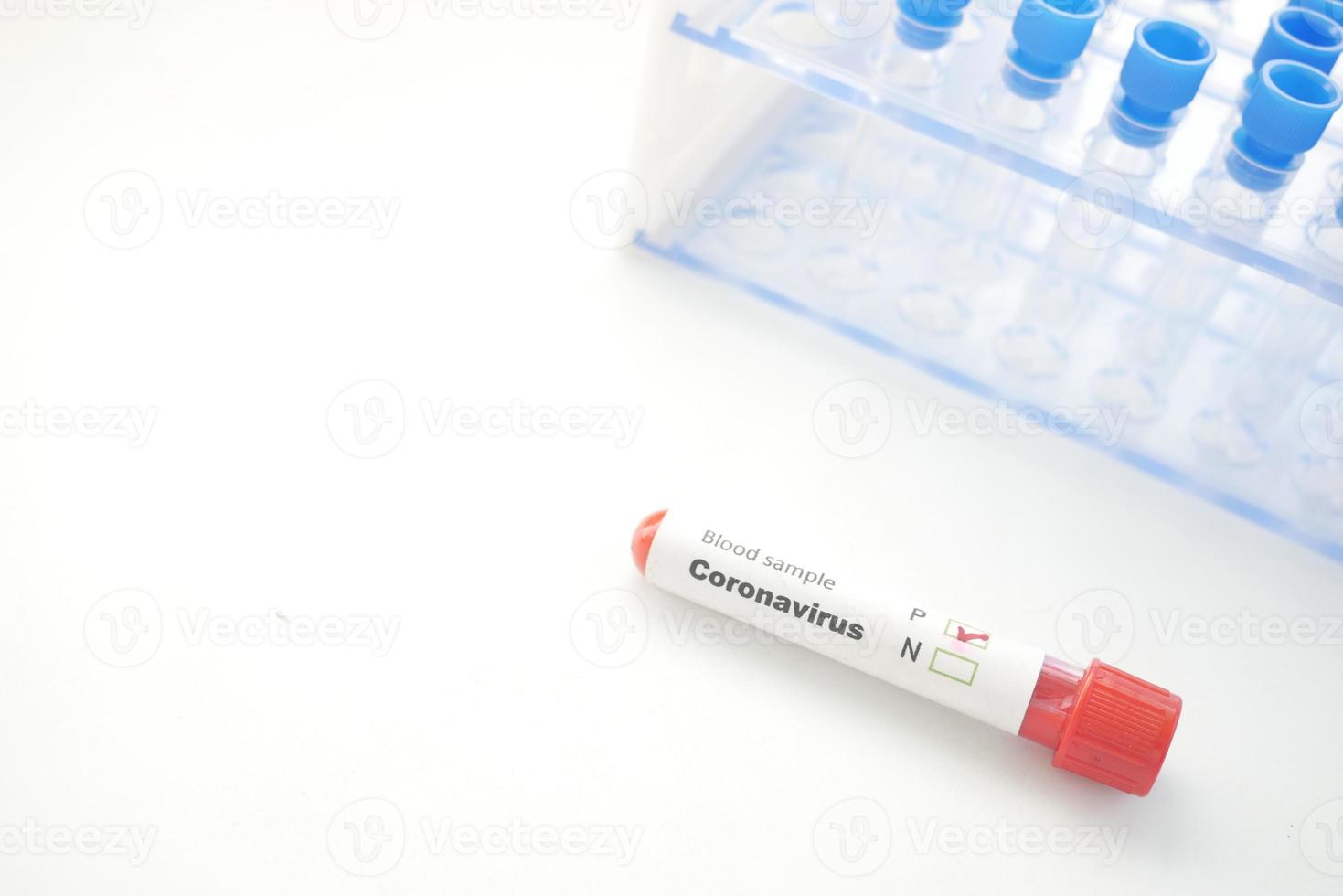 Close up of corona virus blood test tube on white background photo