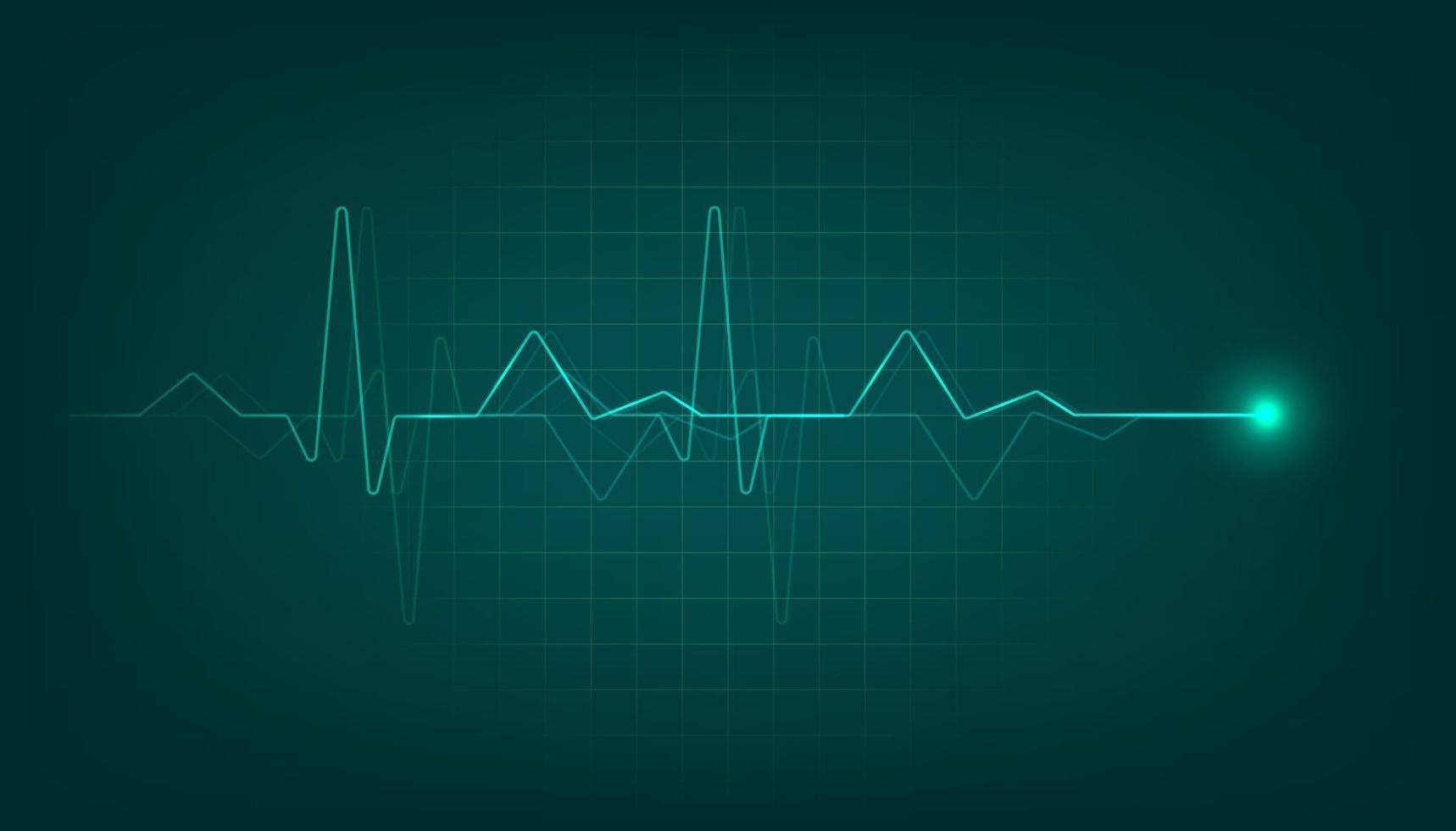 monitor de pulso de corazón verde con señal. Fondo de cardiograma de latido del corazón. vector