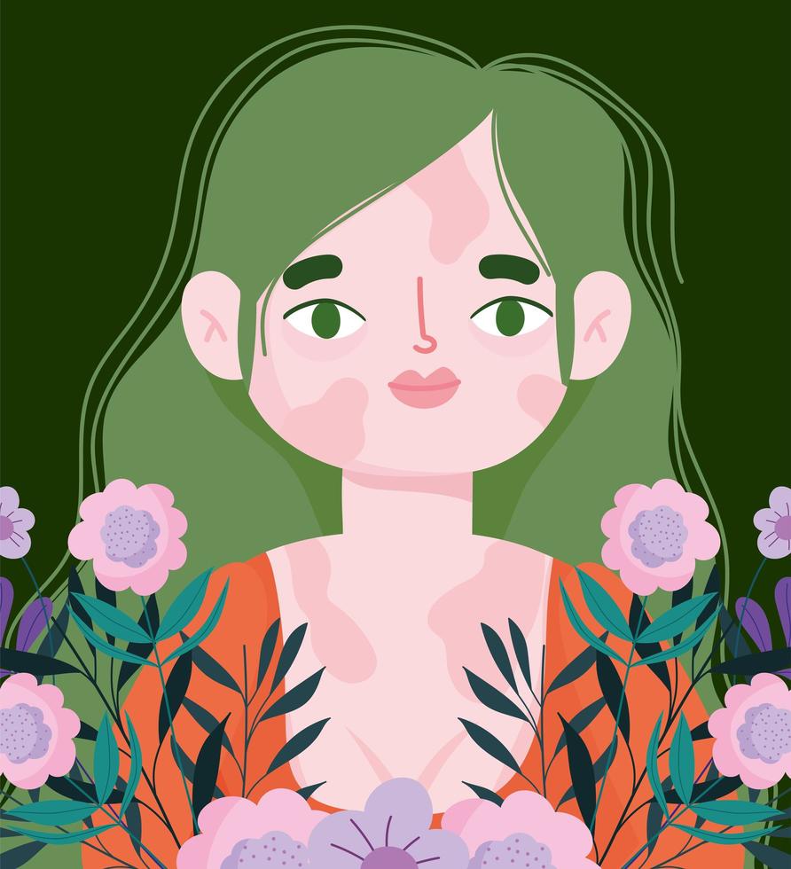 perfectamente imperfecta, mujer joven con vitiligo en la cara y el cuerpo, flores decoración floral vector