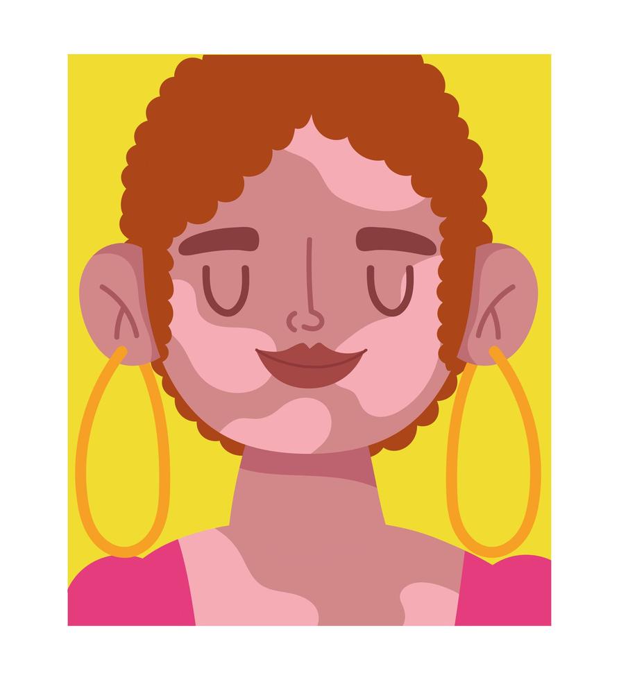 perfectamente imperfecto, rostro de mujer de dibujos animados con vitiligo vector