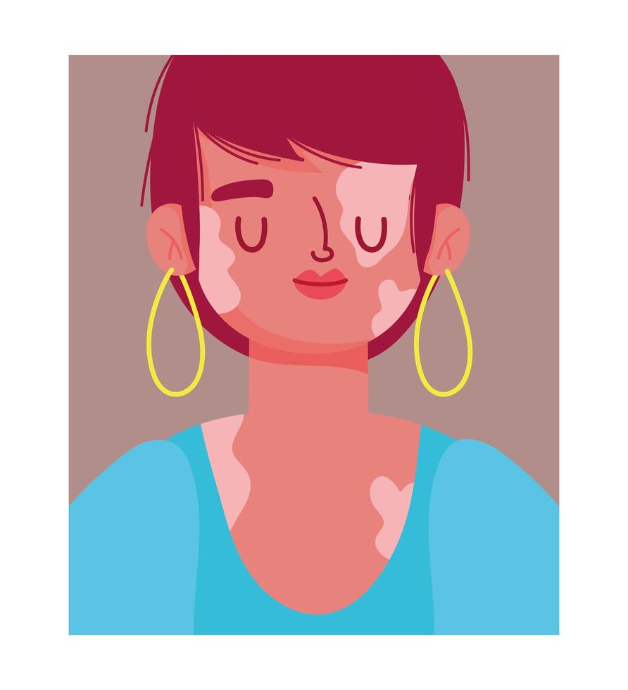 perfectly imperfect, cartoon woman portrait with vitiligo vector