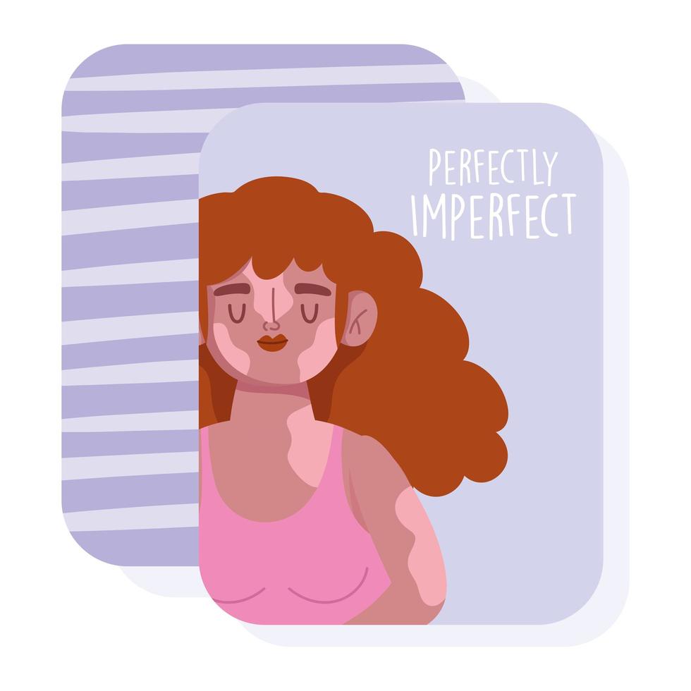 perfectamente imperfecto, mujer de dibujos animados con pelo rizado y vitiligo vector