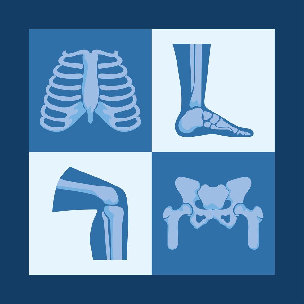 diseños de huesos de reumatología vector