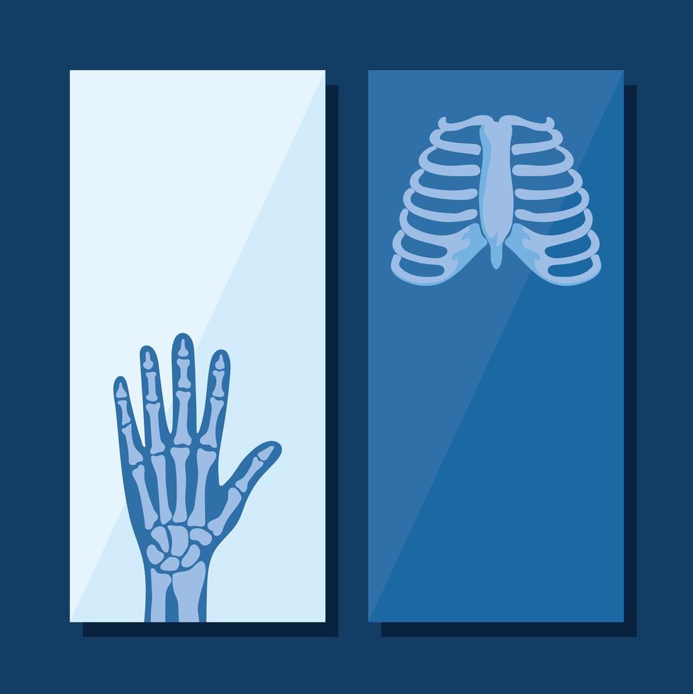 rheumatology posters set vector