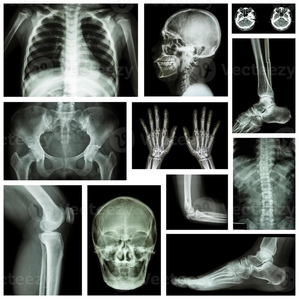 Set of x-ray multiple part of human photo