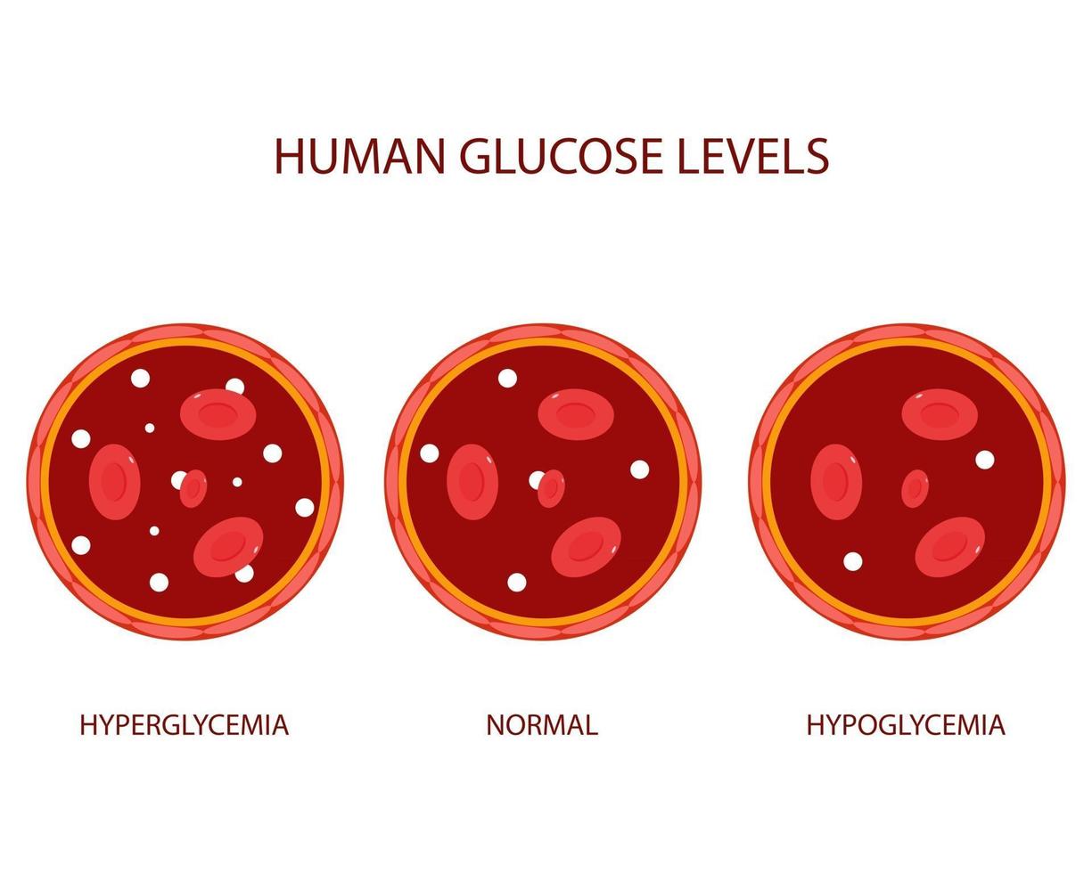 ilustraciones planas de niveles de glucosa en humanos. vector