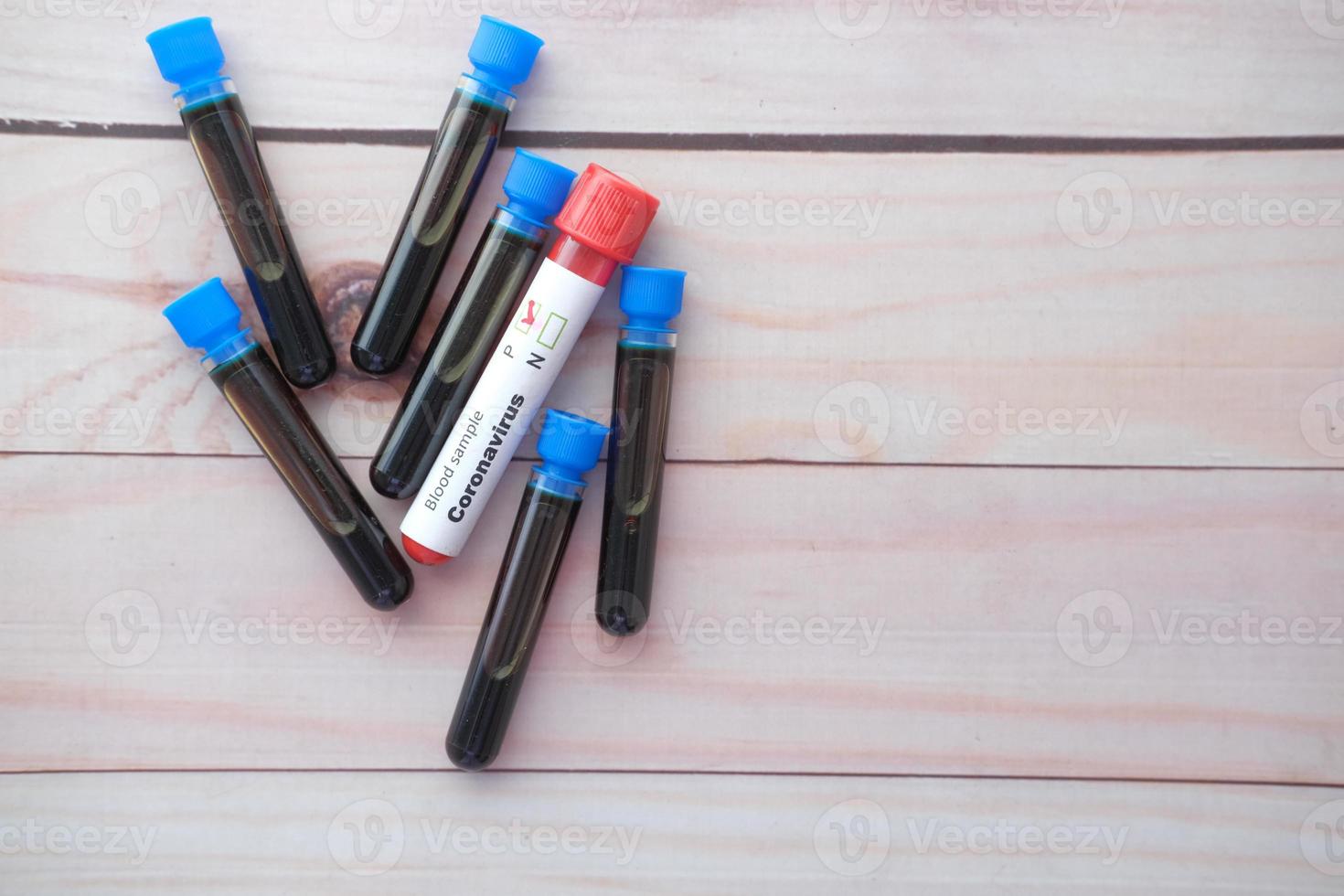 top view of corona virus blood test tube on wooden background photo