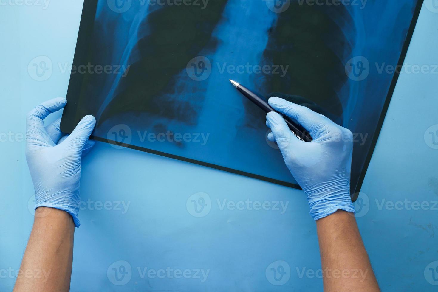 doctor hold analyzing xray photography, closeup photo
