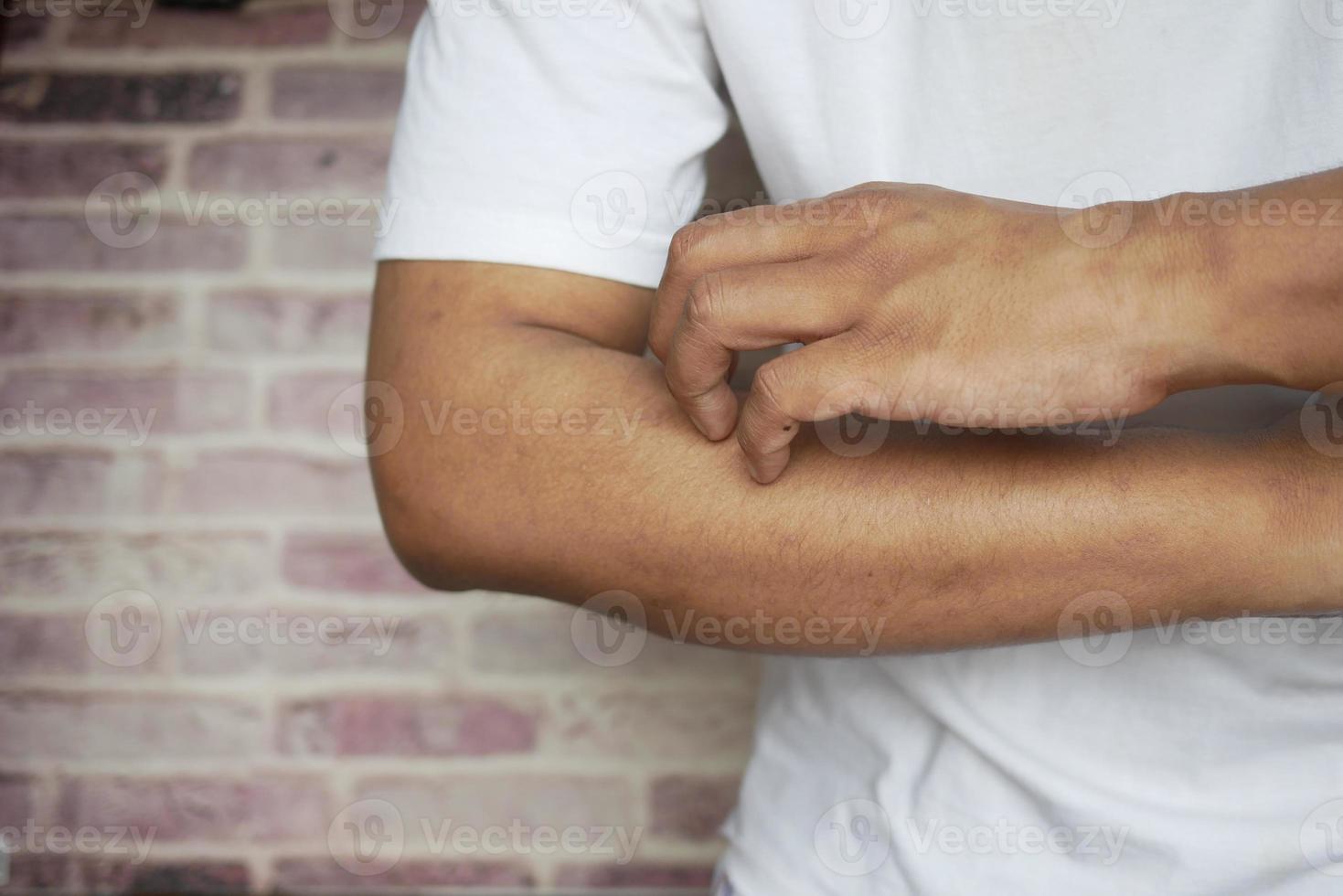 man suffering from itching skin, close up. photo