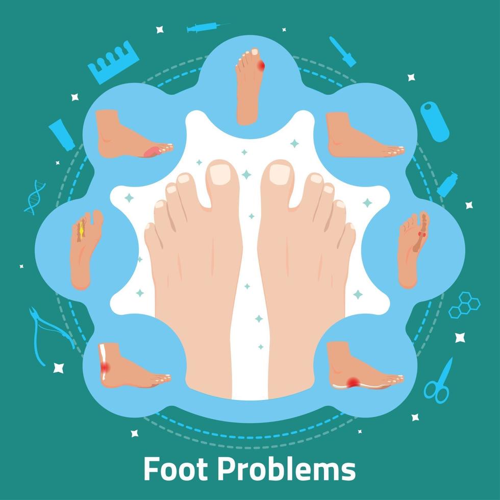 Foot Problems Flat Composition Vector Illustration