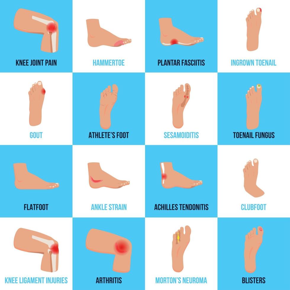 Foot Problems Flat Icons Set Vector Illustration