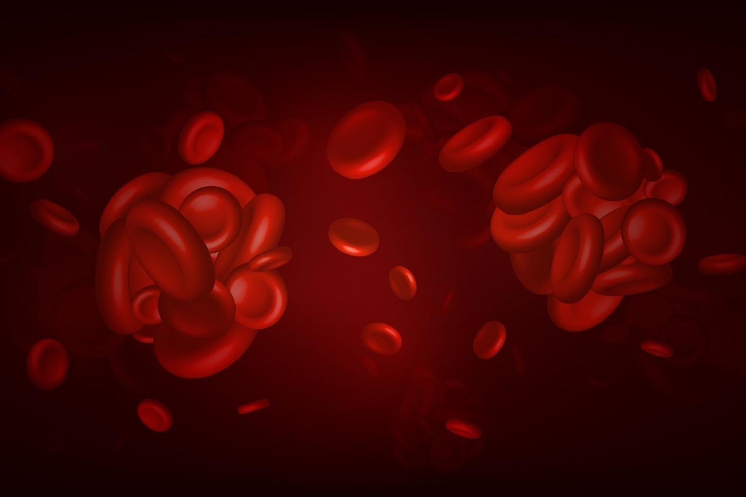 Blood clots thrombus or embolus with coagulated erythrocytes vector