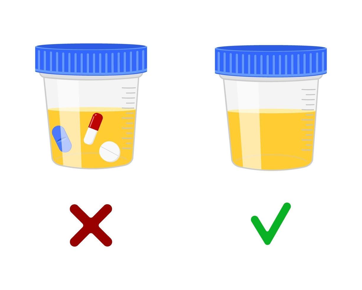 Urinalysis, urine samples with and without drugs. Doping control in sport, post accident drug testing concept vector